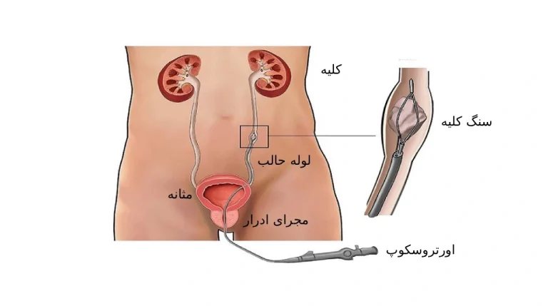 اورتروسکوپی