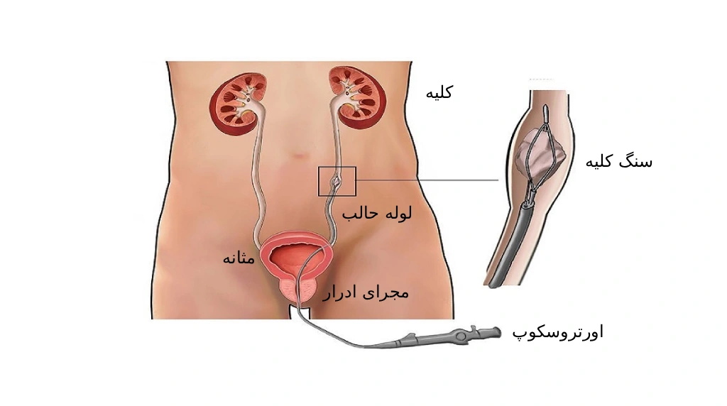 اورتروسکوپی