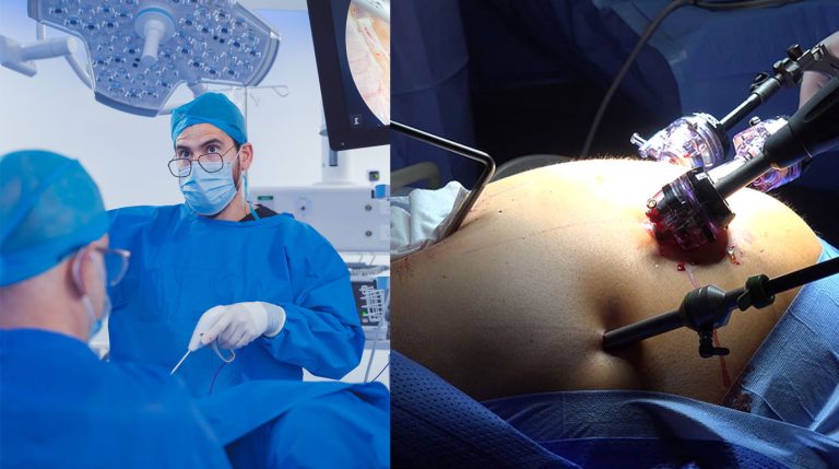 عمل اسلیو پلاس