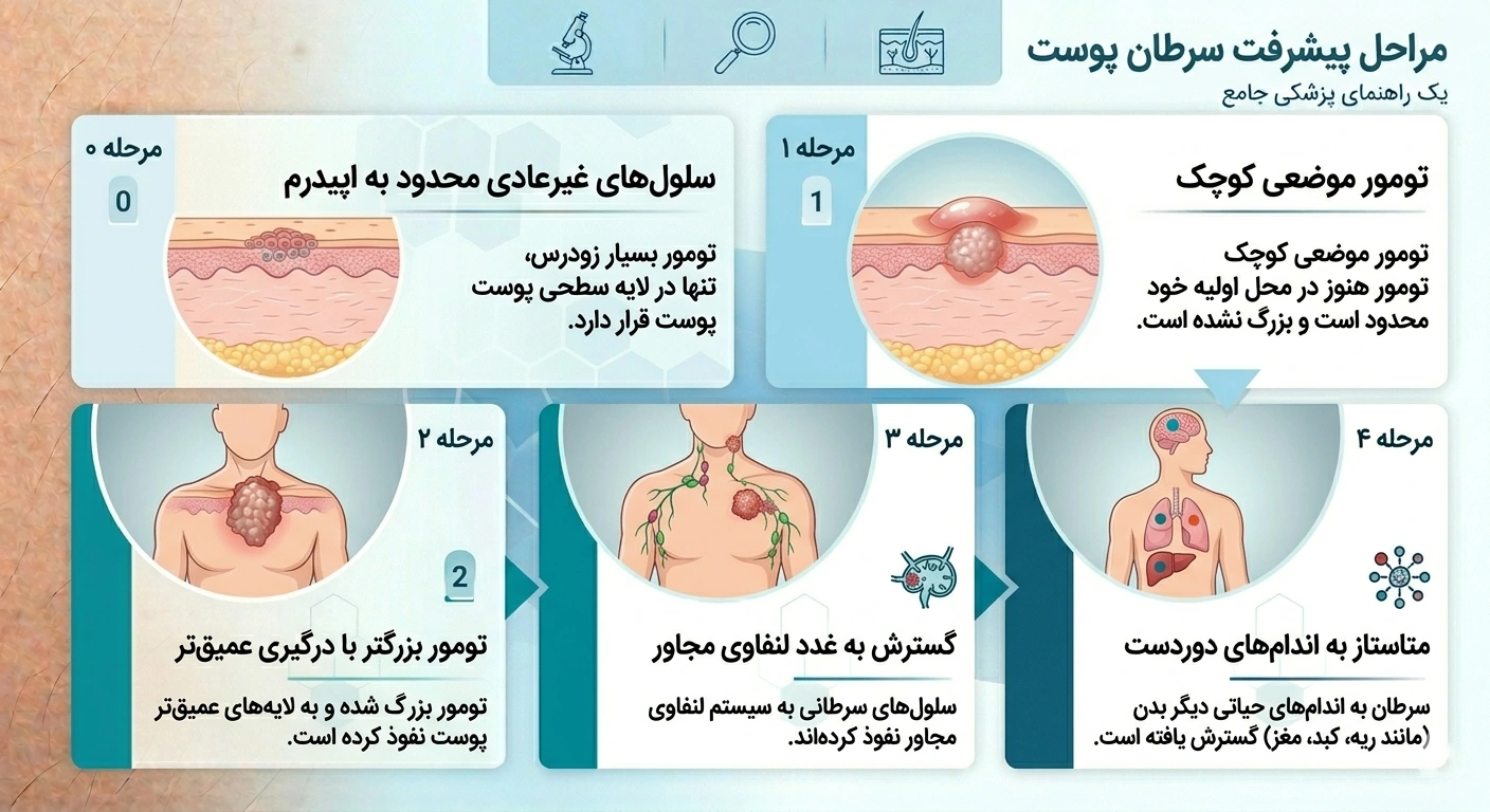 مراحل سرطان پوست