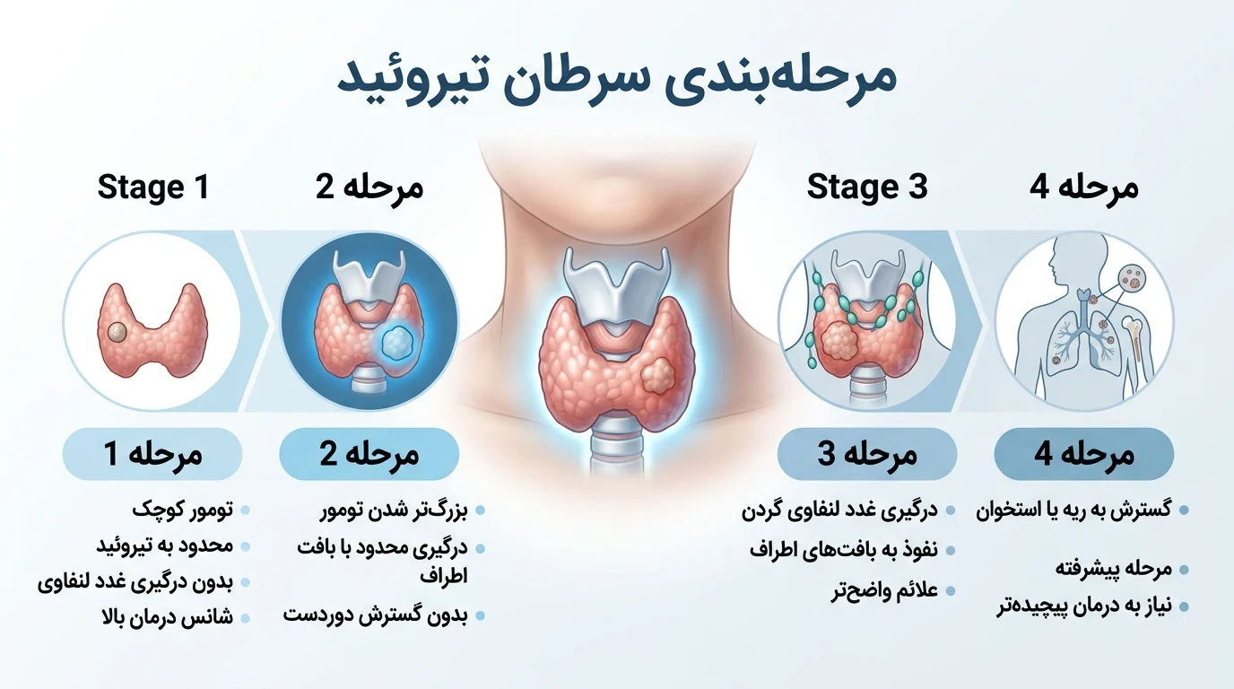مرحلهبندی سرطان تیروئید