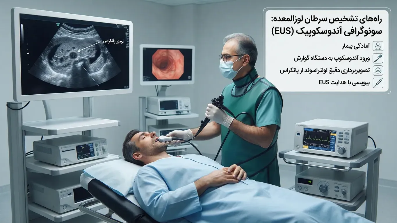راه‌های تشخیص سرطان لوزالمعده