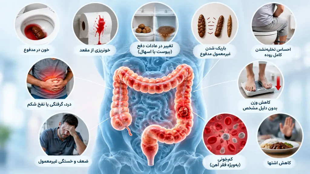 علائم سرطان روده بزرگ