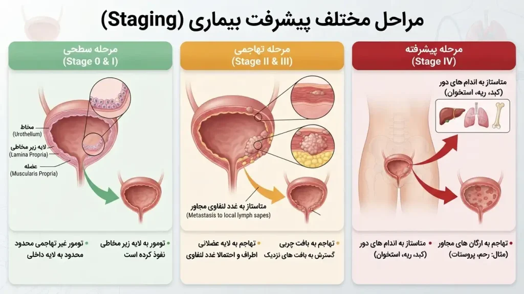 مراحل مختلف پیشرفت بیماری (Staging)