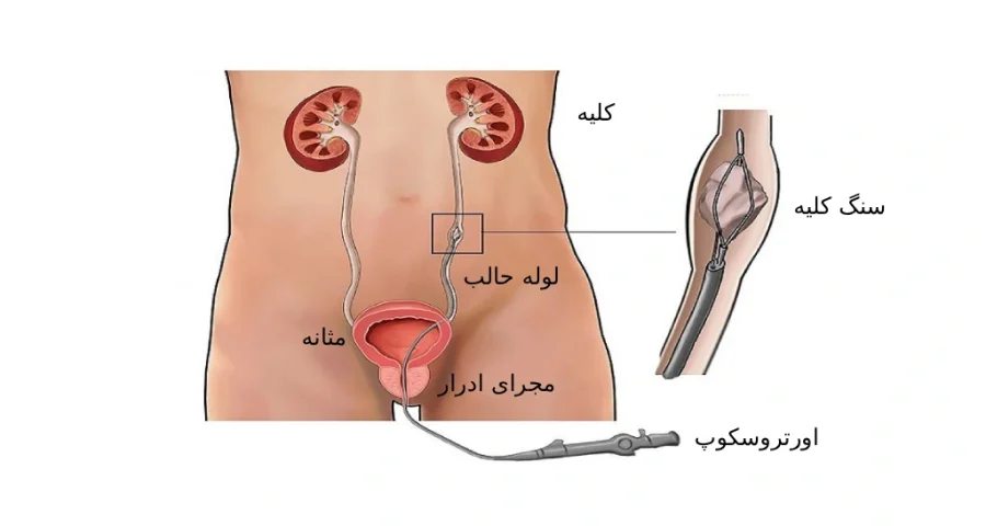 اورتروسکوپی